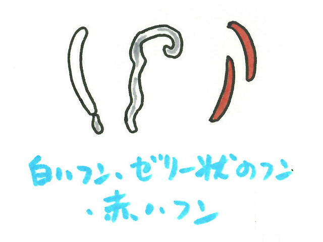 白いフン・ゼリー状のフン・赤いフンのイラスト画像