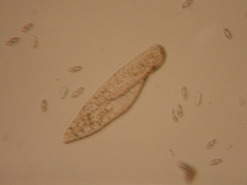 顕微鏡で拡大されたゾウリムシと周囲の微生物群