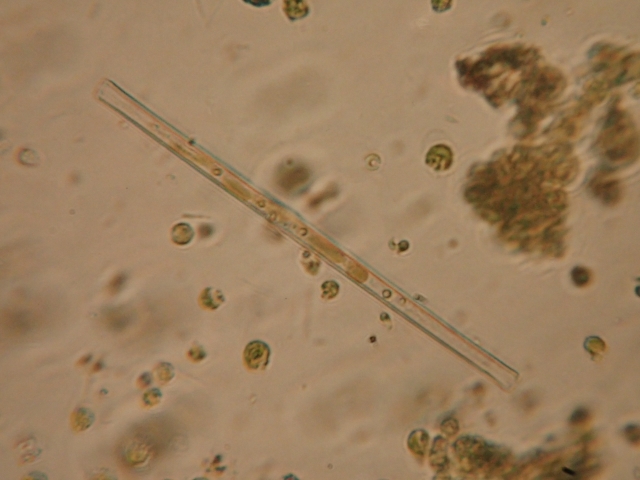 顕微鏡で拡大された細長い珪藻と微生物の顕微鏡写真